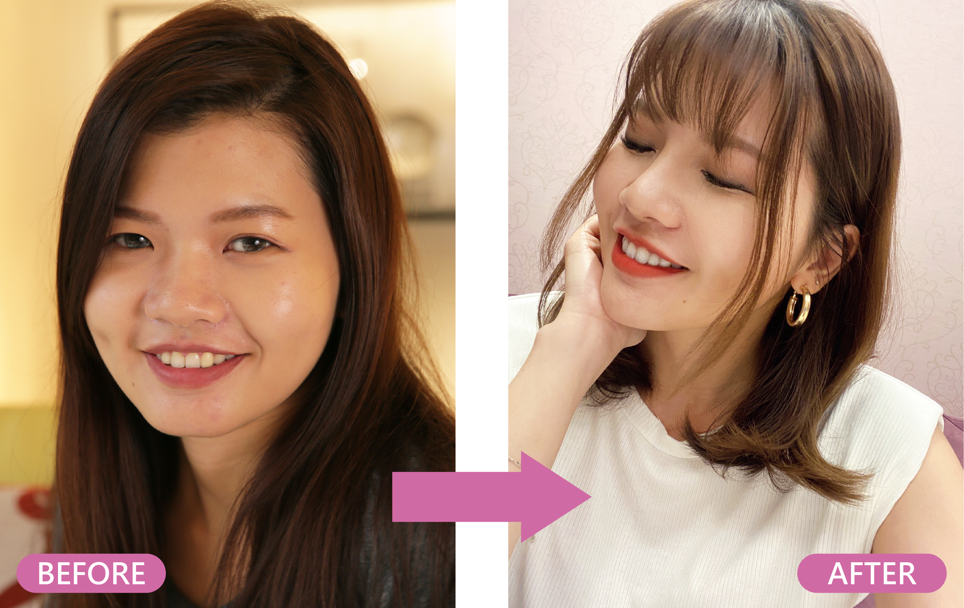 案例 NIKI 前後對比照