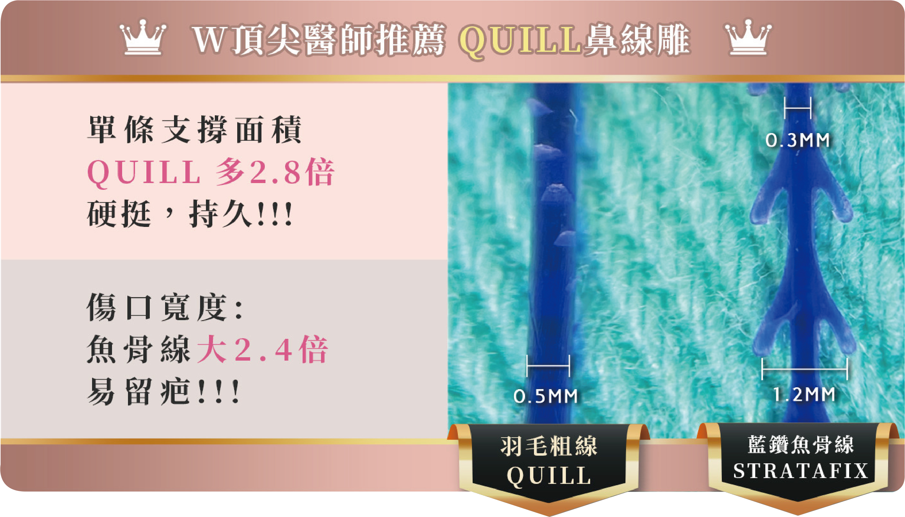 合法可吸收鼻雕線材示意圖