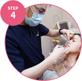 依需求搭配填充修飾鼻曲線