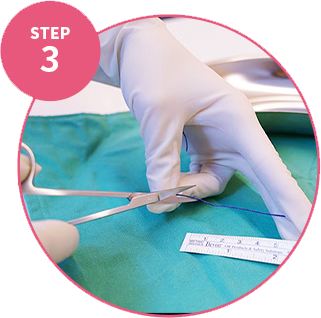 現場拆封無菌裁剪製作線雕組