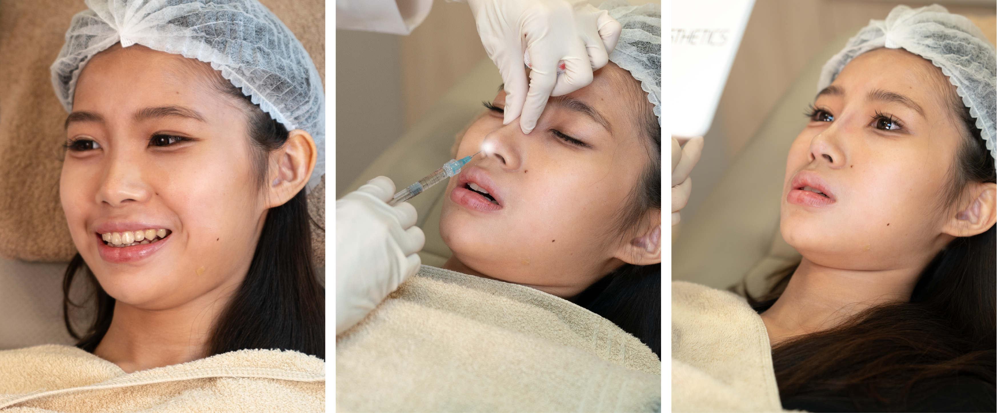 W頂尖鼻線雕 醫師施作畫面